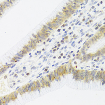 Anti-CDK6 Antibody (CAB3165)