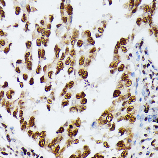 Anti-HNRNPD Antibody (CAB15679)