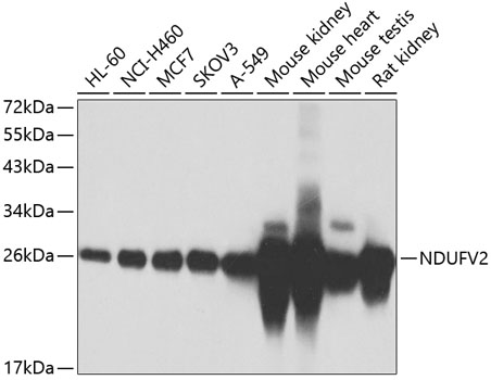 Anti-NDUFV2 Antibody (CAB7442)