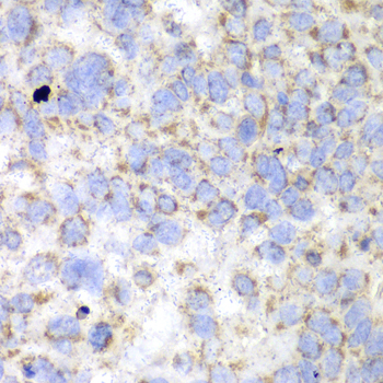 Anti-HADHA Antibody (CAB13310)