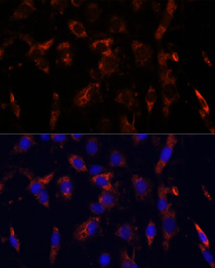 Anti-CD44 Antibody (CAB16806)