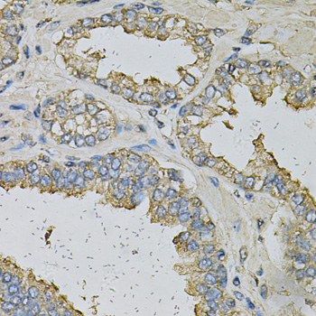 Anti-ALDH3A1 Antibody (CAB13275)