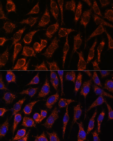 Anti-NUP210 Antibody (CAB16676)