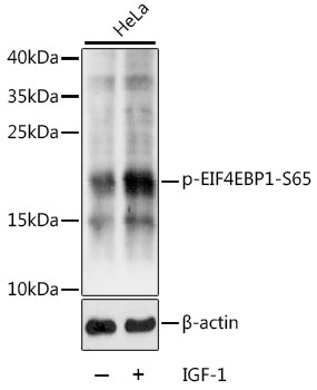 Anti-Phospho-EIF4EBP1-S65 Antibody (CABP0032)