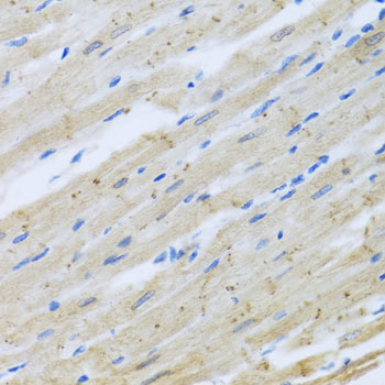 Anti-CLIP1 Antibody (CAB7722)