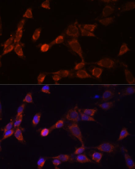 Anti-PSMD14 Antibody (CAB10782)