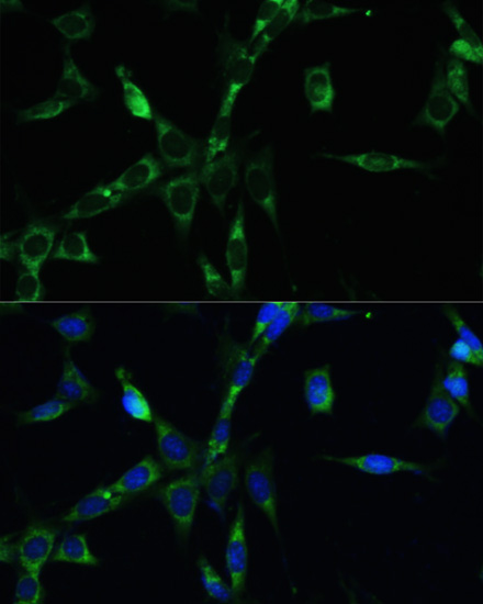 Anti-BUB1B Antibody (CAB1775)