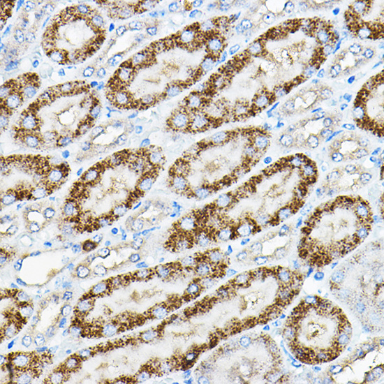 Anti-ALPL Antibody (CAB12396)