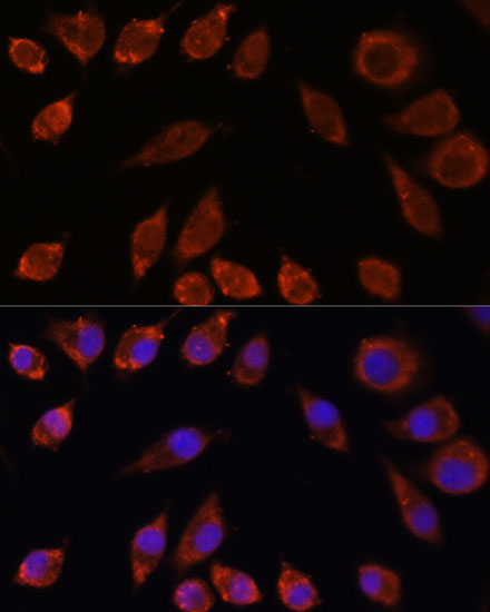 Anti-HPS4 Antibody (CAB16157)