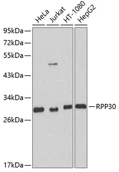 Anti-RPP30 Polyclonal Antibody (CAB8479)