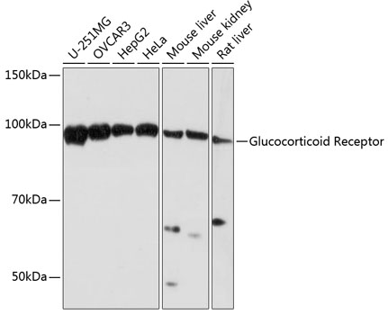 Anti-Glucocorticoid Receptor Antibody (CAB19583)