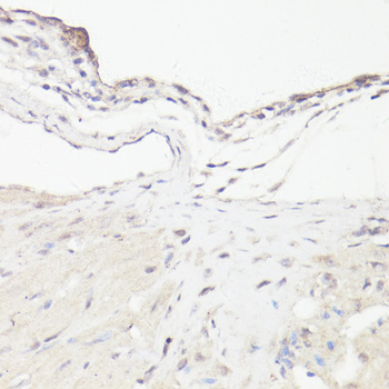 Anti-DMP1 Antibody (CAB16832)