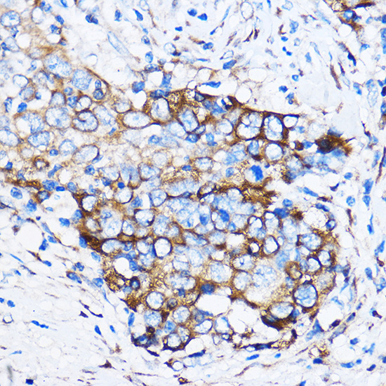 Anti-Chk1 Antibody (CAB7653)