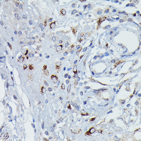 Anti-DFNA5/GSDME Antibody (CAB7432)