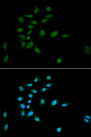 Anti-PSMA1 Antibody (CAB2523)
