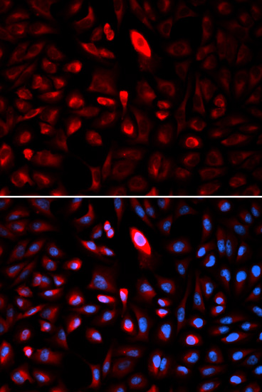 Anti-TCP1 Antibody (CAB1950)