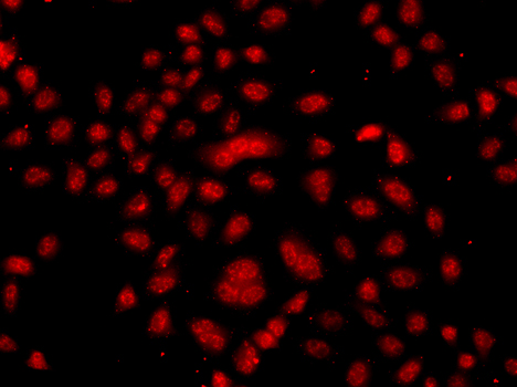 Anti-FBXW11 Antibody (CAB7784)