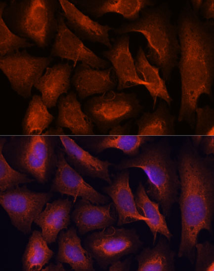 Anti-MALT1 Antibody (CAB2144)