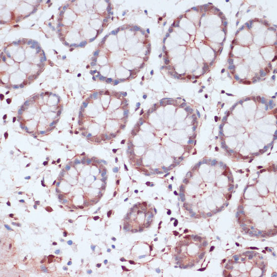 Anti-S100A5 Antibody (CAB14779)