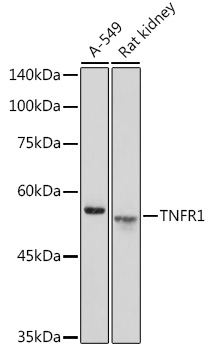 Anti-TNFR1 Antibody (CAB1540)