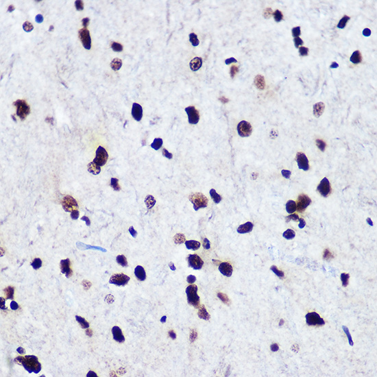 Anti-Phospho-Smad2-S465/467 + Smad3-S423/425 Antibody (CABP0548)