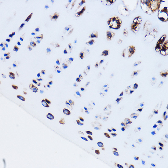 Anti-PTH1R Antibody (CAB1744)