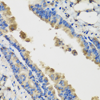 Anti-IL36G Polyclonal Antibody (CAB8304)