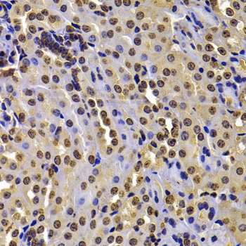 Anti-WHSC1 Antibody (CAB7938)