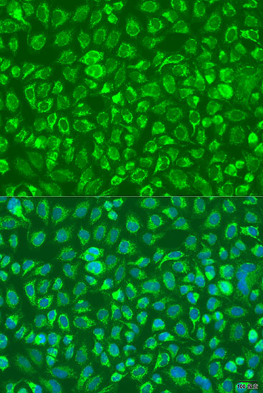 Anti-Complement C5 Polyclonal Antibody (CAB8104)