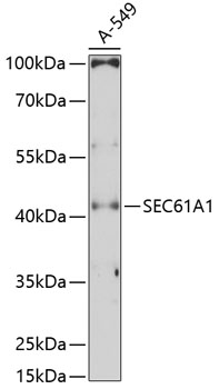 Anti-SEC61A1 Antibody (CAB11614)