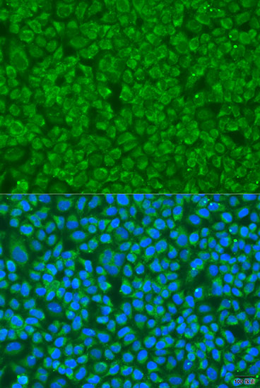 Anti-GOSR1 Antibody (CAB4316)