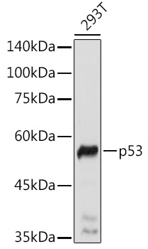 Anti-p53 Antibody [KO Validated] (CAB11232)