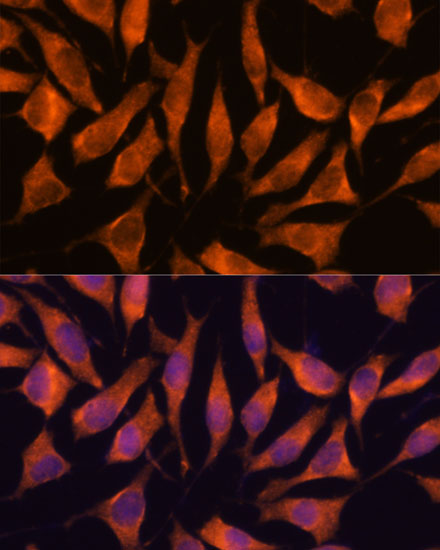 Anti-LHPP Antibody (CAB14342)