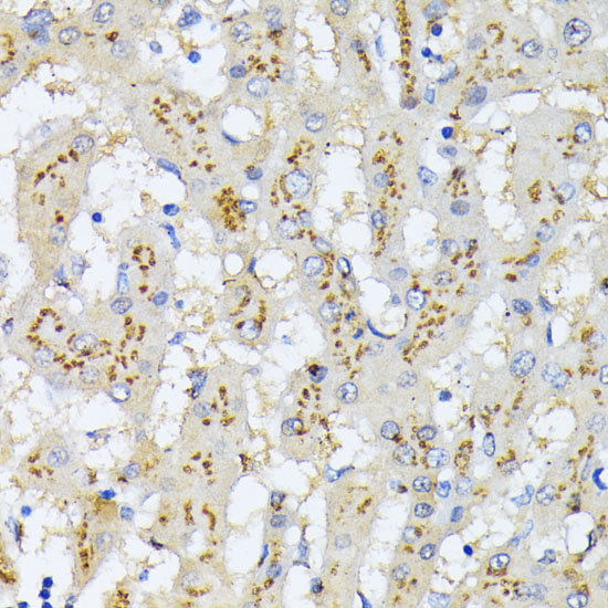 Anti-GOLM1 Antibody (CAB12584)