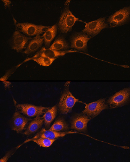 Anti-C1 Inactivator Antibody (CAB1717)