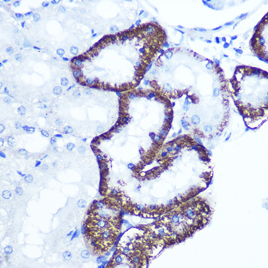 Anti-EXTL3 Antibody (CAB3857)