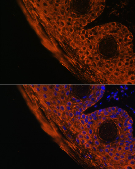 Anti-TGM1 Antibody (CAB7343)