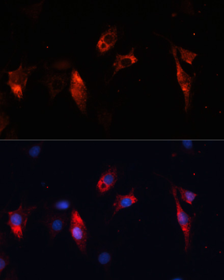 Anti-CTSL Antibody (CAB12066)