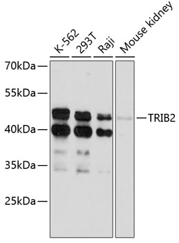 Anti-TRIB2 Antibody (CAB11661)