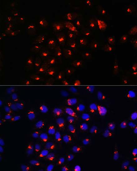 Anti-SGMS1 Antibody (CAB15008)