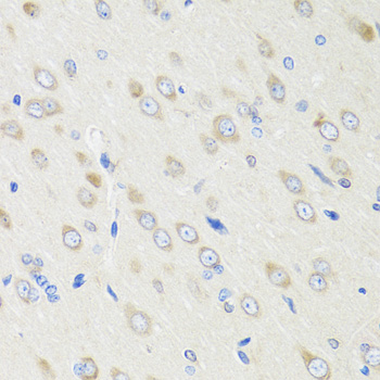 Anti-CRABP2 Antibody (CAB6119)