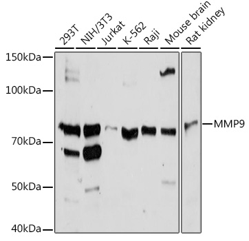 Anti-MMP9 Antibody (CAB0289)