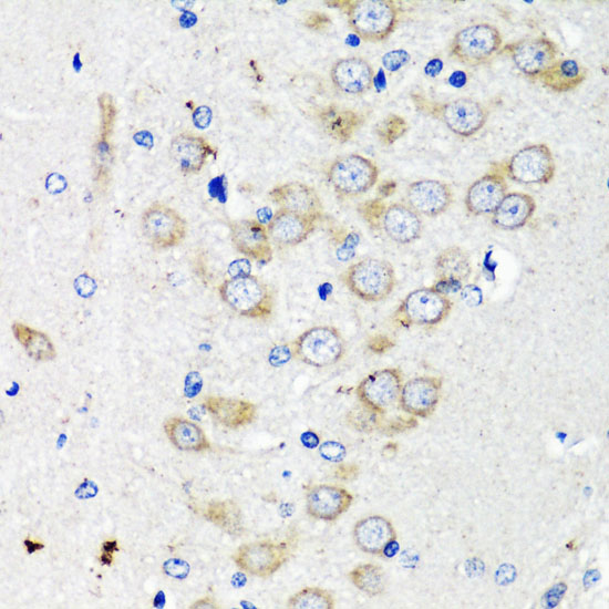 Anti-TSC2 Antibody (CAB0492)