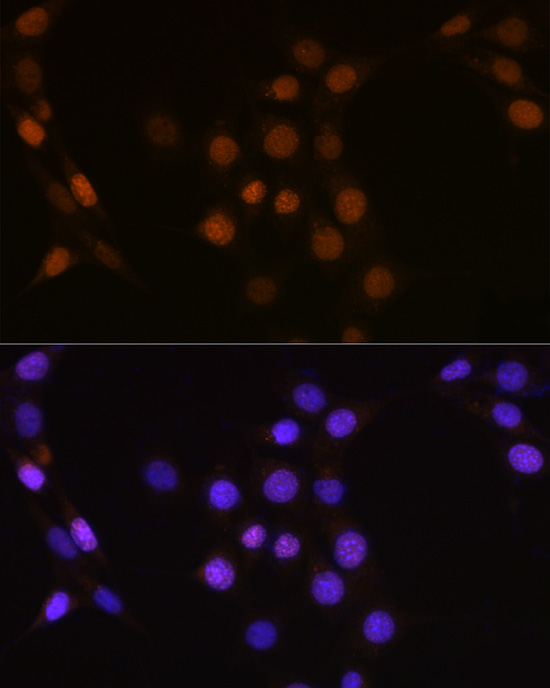 Anti-CDC25A Antibody (CAB1173)