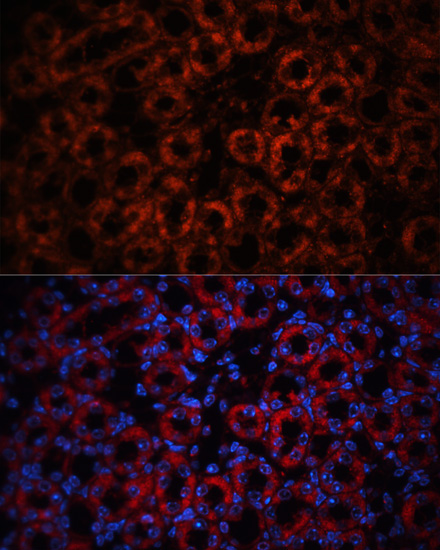 Anti-LCN2 Antibody (CAB3176)