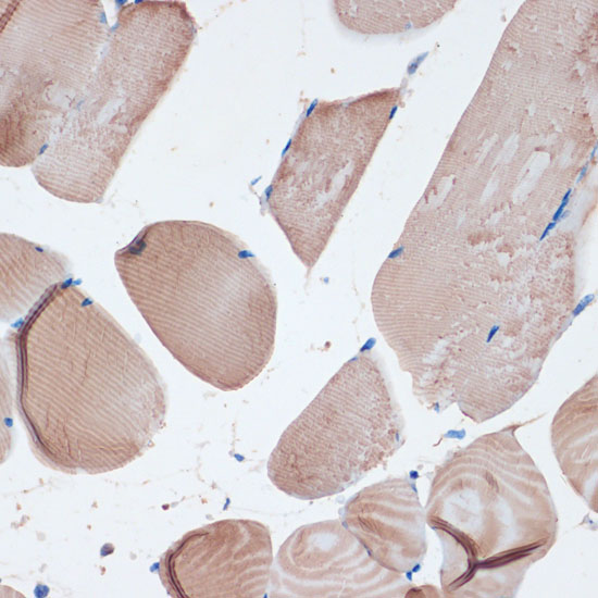 Anti-MYH7 Antibody (CAB7564)