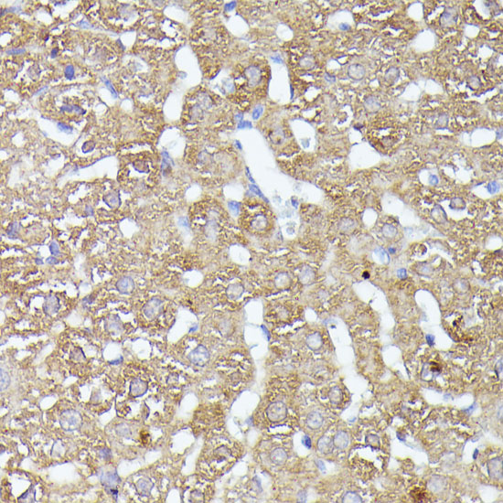 Anti-CDK5RAP1 Antibody (CAB15844)