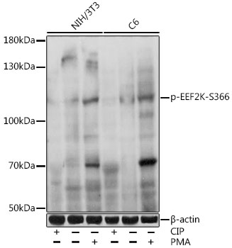 Anti-Phospho-EEF2K-S366 pAb (CABP0845)