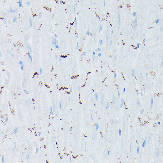 Anti-N-Cadherin Antibody [KO Validated] (CAB0432)