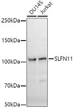 Western blot analysis of extracts of various cell lines, using SLFN11 antibody at 1:1000 dilution. Secondary antibody: HRP Goat Anti-Rabbit IgG (H+L) at 1:10000 dilution. Lysates/proteins: 25ug per lane. Blocking buffer: 3% nonfat dry milk in TBST. Detection: ECL Basic Kit. Exposure time: 10s.